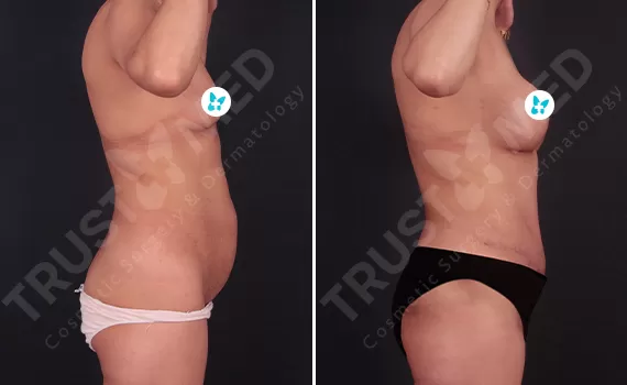 Before After Trustmed