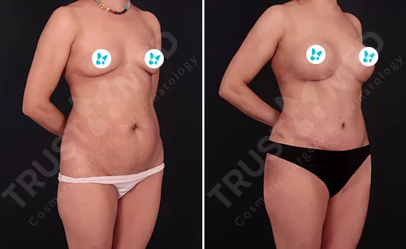 Before After Trustmed