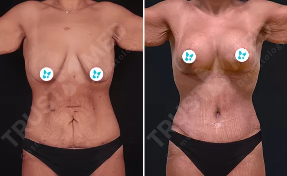 Before After Trustmed