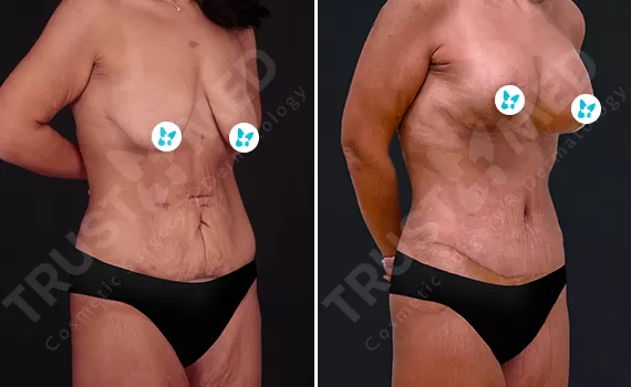 Before After Trustmed