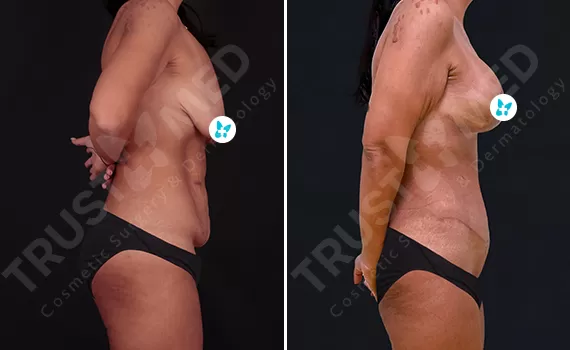Before After Trustmed