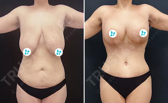 Before After Trustmed