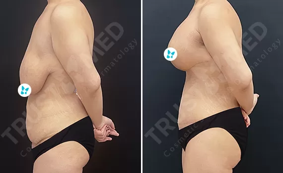 Before After Trustmed