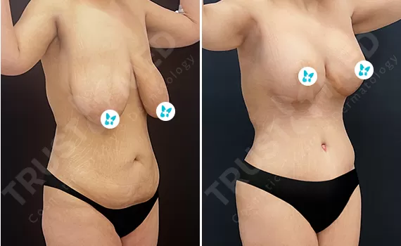 Before After Trustmed
