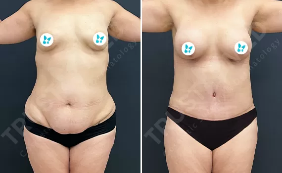 Before After Trustmed