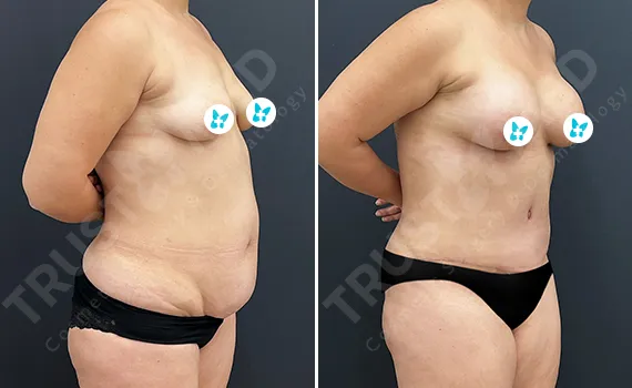 Before After Trustmed