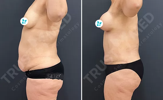Before After Trustmed