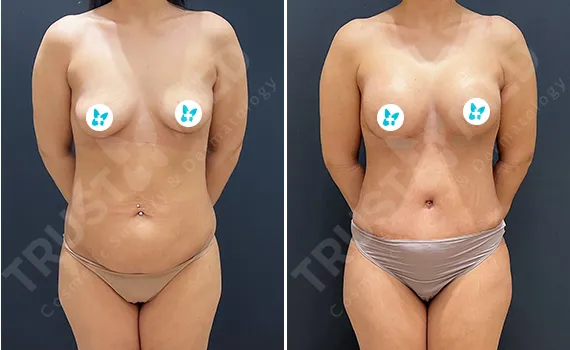 Before After Trustmed