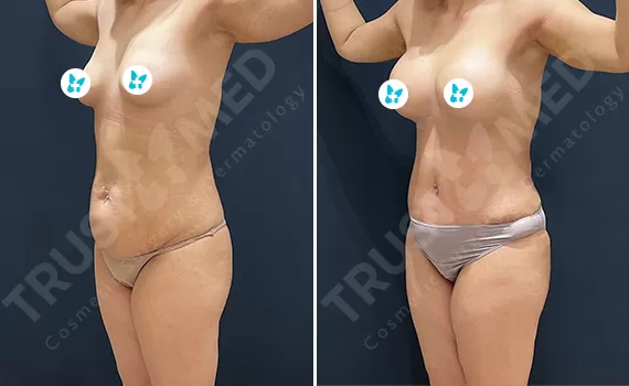 Before After Trustmed