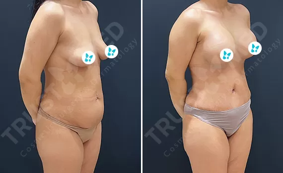 Before After Trustmed