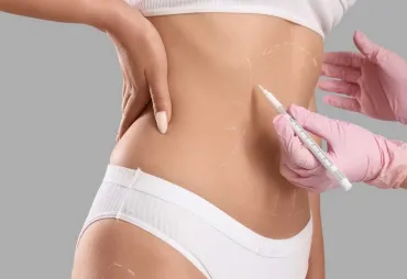 All About Extended Abdominoplasty: Who Needs It Most?