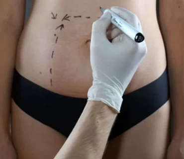 Pros and cons of planning maternity plastic surgery on children's vacation