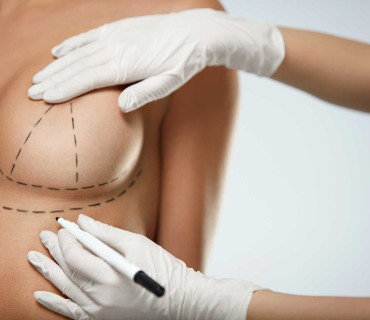 Beyond Expectations: The Science of Breast Lift Surgery in Turkey