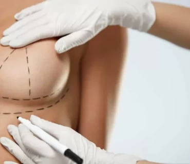 Beyond Expectations: The Science of Breast Lift Surgery in Turkey