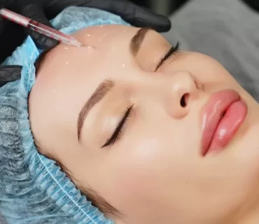 Beyond Wrinkles: Botox Injections as a Treatment for Migraines