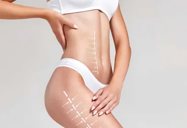 Body Surgery and Skin Tightening: Achieving the Perfect Look