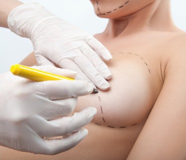 Breast Fat Injection