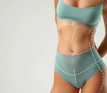 Combining Tummy Tuck and Liposuction: Is It Safe?