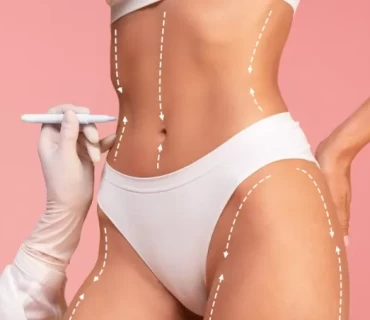 Everything You Need To Know About Body Aesthetics In Turkey