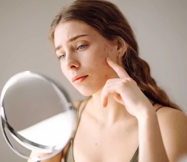 FILS (Fat Injection with Laser and Stem Cell): A Revolutionary Treatment for Acne Scars in Turkey