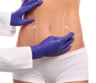 High-Definition Liposuction vs. Conventional Methods