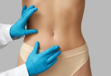 How to Choose an Abdominoplasty Technique That Fits You
