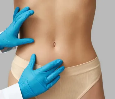 How to Choose an Abdominoplasty Technique That Fits You