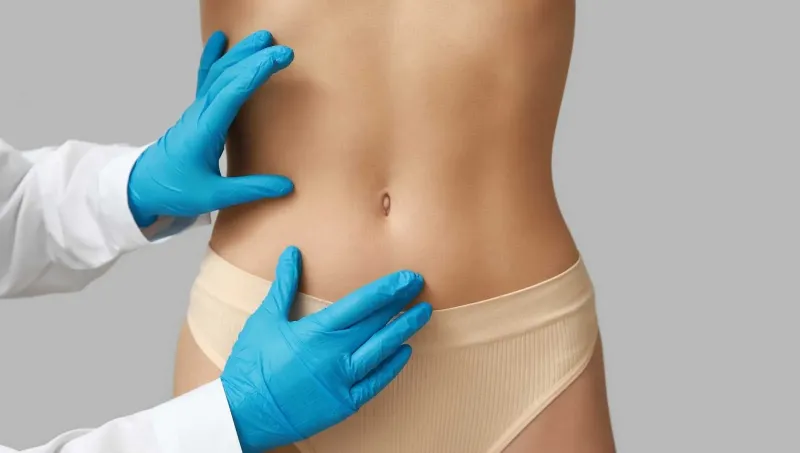 How to Choose an Abdominoplasty Technique That Fits You