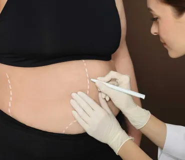 Bariatric Surgery