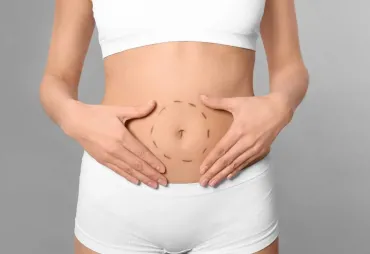 Is Mini Tummy Tuck Right for You?
