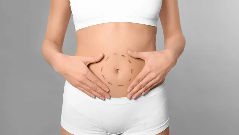 Is Mini Tummy Tuck Right for You?