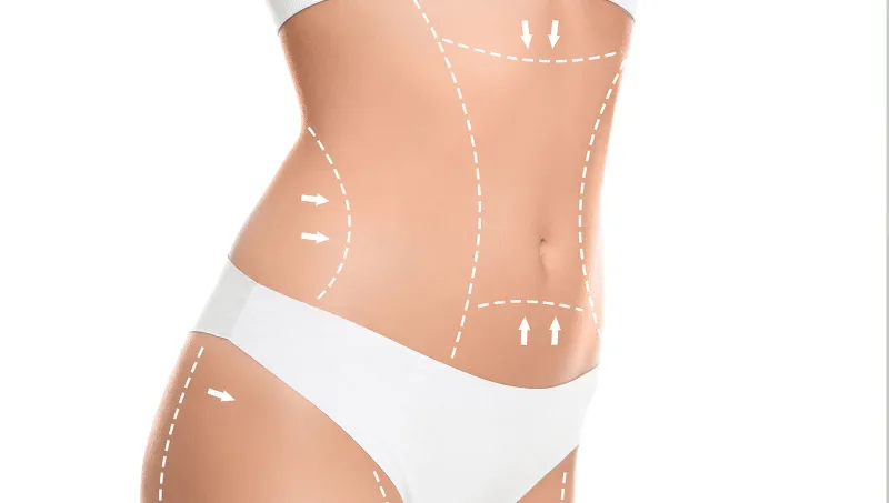 Managing Pain After Your Body Surgery in Turkey