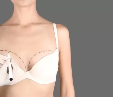 Natural Breast Augmentation: Exploring Breast Fat Injection in Turkey
