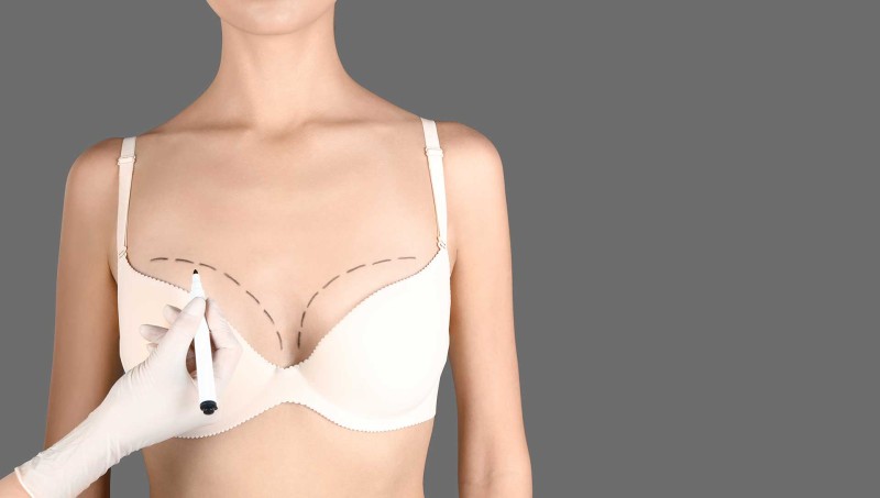 Natural Breast Augmentation: Exploring Breast Fat Injection in Turkey