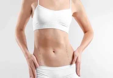 Recovery Timeline for Abdominoplasty Patients