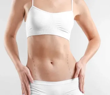 Recovery Timeline for Abdominoplasty Patients