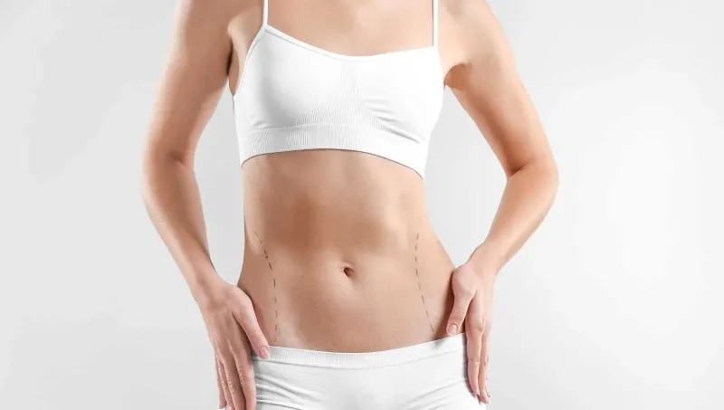 Recovery Timeline for Abdominoplasty Patients