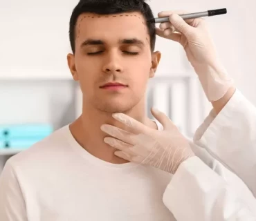 Roots of Success: How Turkey Became the Global Hub for Hair Transplantation