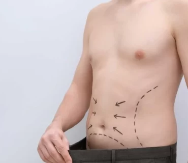 Sculpting Masculinity: Liposuction for Men in Turkey