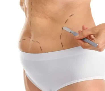 Understanding Liposuction Risks and Benefits