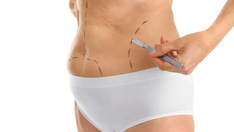 Understanding Liposuction Risks and Benefits