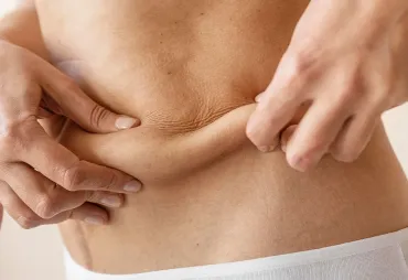Understanding Liposuction Technologies: Laser vs. Ultrasound