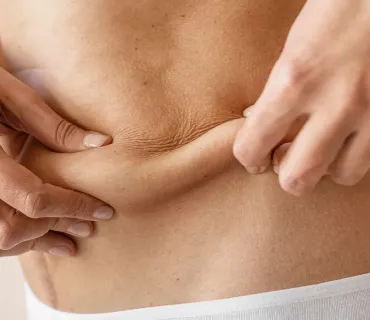 Understanding Liposuction Technologies: Laser vs. Ultrasound