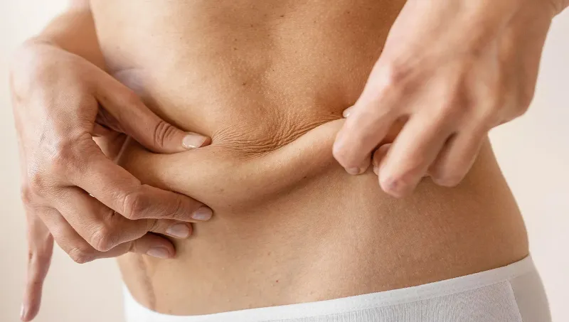 Understanding Liposuction Technologies: Laser vs. Ultrasound