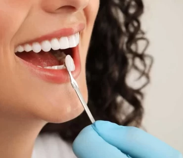 What Are The Qualities Of Poorly Done Dental Veneers?