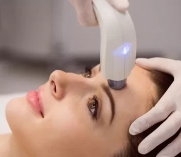 What Is Fractional Laser Treatment in Dermatology?
