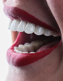 Zirconium Porcelain Crown