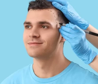 Why Turkey? Unveiling the Secrets Behind Successful Hair Transplants