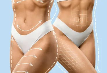 Why Turkey’s Clinics Are Renowned for Body Surgeries