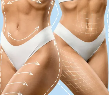 Why Turkey’s Clinics Are Renowned for Body Surgeries